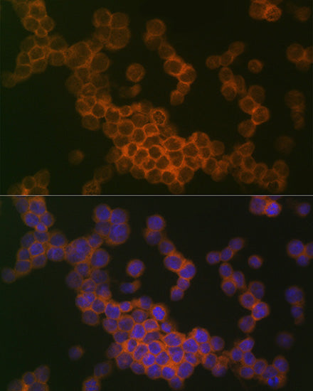 HLA B7 Rabbit mAb