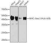 MHC class I (HLA-A/B) Rabbit mAb