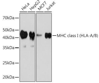 MHC class I (HLA-A/B) Rabbit mAb