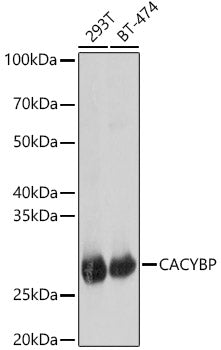 [KO Validated] CACYBP Rabbit pAb