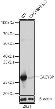 [KO Validated] CACYBP Rabbit pAb