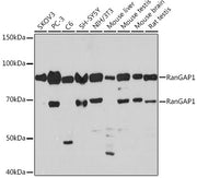 RanGAP1 Rabbit mAb