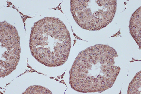 RanGAP1 Rabbit mAb