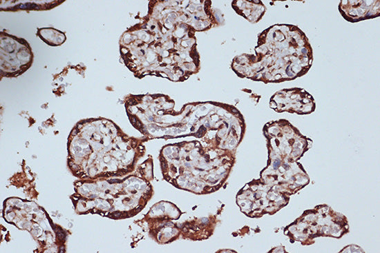 RanGAP1 Rabbit mAb