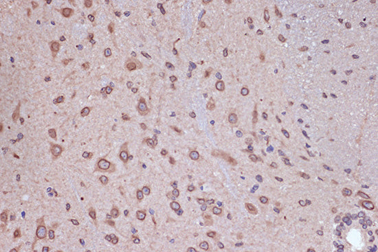RanGAP1 Rabbit mAb
