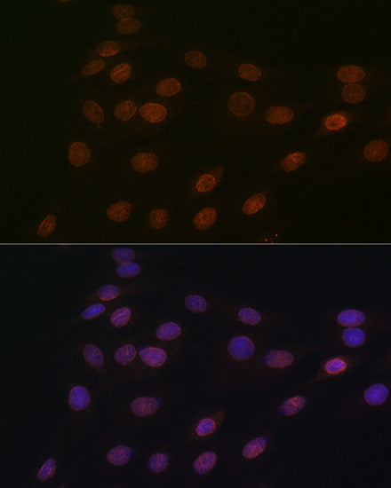 RanGAP1 Rabbit mAb