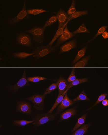 RanGAP1 Rabbit mAb