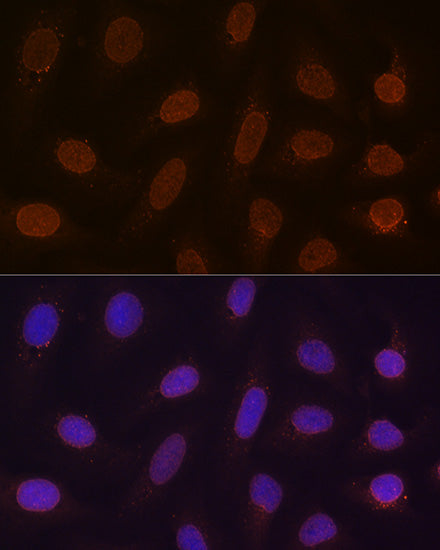 RanGAP1 Rabbit mAb