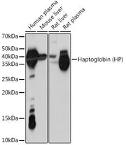 Haptoglobin (HP) Rabbit mAb