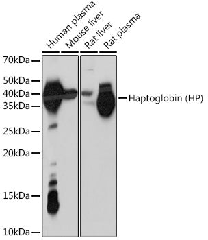 Haptoglobin (HP) Rabbit mAb