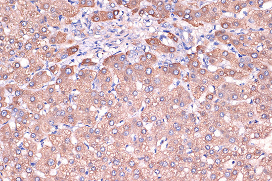Haptoglobin (HP) Rabbit mAb