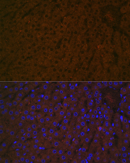 Haptoglobin (HP) Rabbit mAb