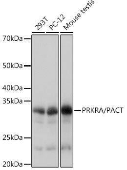 PRKRA/PACT Rabbit mAb