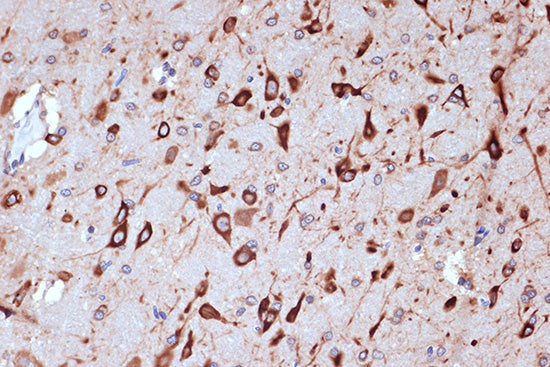PRKRA/PACT Rabbit mAb