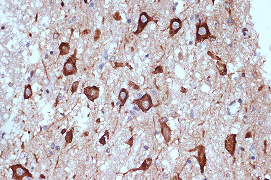 PRKRA/PACT Rabbit mAb