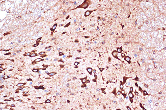 PRKRA/PACT Rabbit mAb