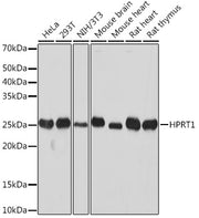 [KO Validated] HPRT1 Rabbit mAb