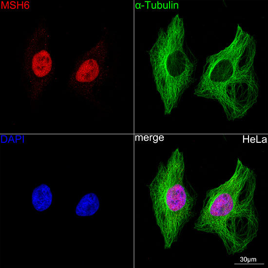 MSH6 Rabbit mAb