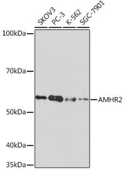 AMHR2 Rabbit mAb