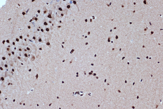BUB3 Rabbit mAb