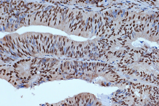 BUB3 Rabbit mAb
