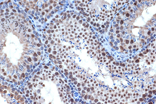 BUB3 Rabbit mAb