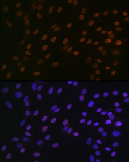BUB3 Rabbit mAb