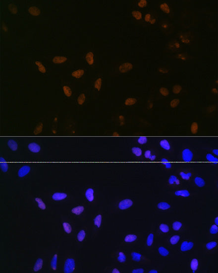 BUB3 Rabbit mAb