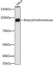Butyrylcholinesterase Rabbit mAb