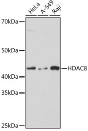 HDAC8 Rabbit mAb