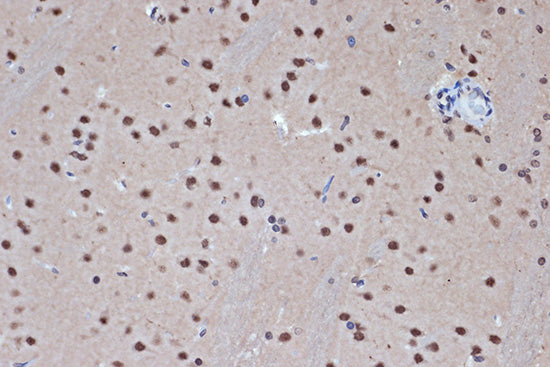HDAC8 Rabbit mAb