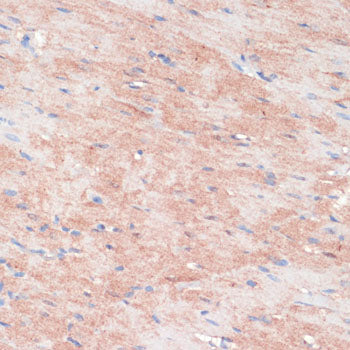 RPIA Rabbit pAb