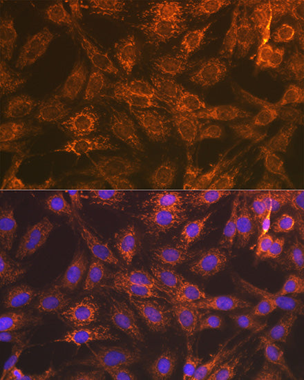 Smac/Diablo Rabbit mAb