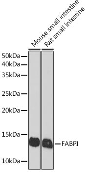 FABPI Rabbit mAb
