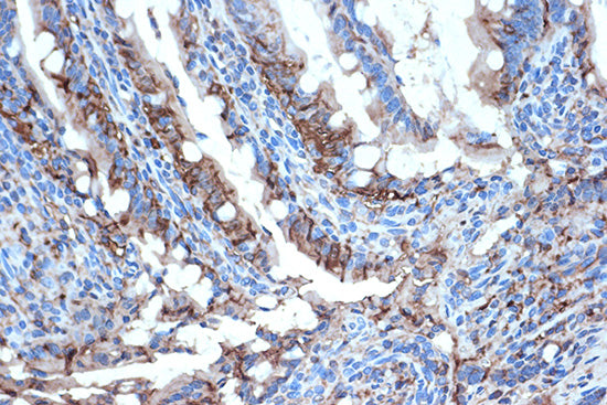 FABPI Rabbit mAb