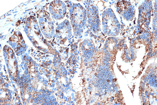 FABPI Rabbit mAb
