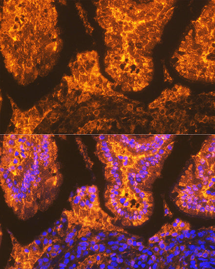 FABPI Rabbit mAb
