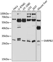SNRPB2 Rabbit pAb