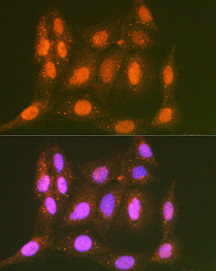 LTA4H Rabbit mAb