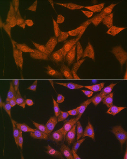 LTA4H Rabbit mAb