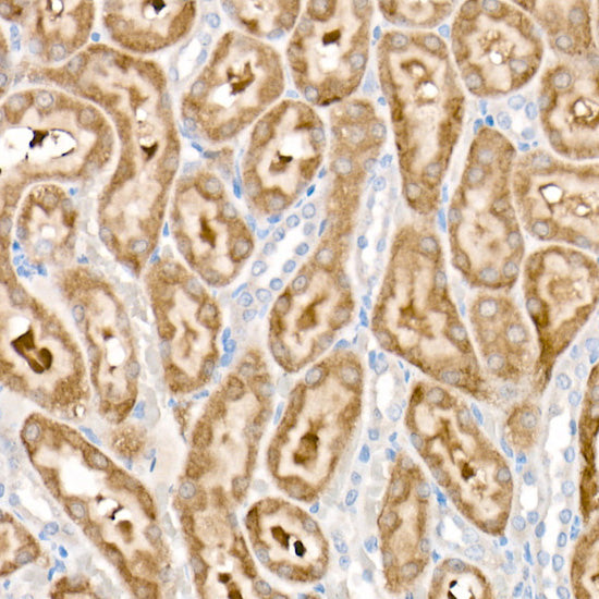 PDK1/PDHK1 Rabbit mAb
