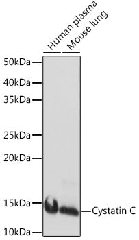 Cystatin C Rabbit mAb