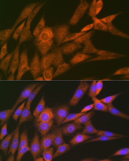 14-3-3 Theta Rabbit mAb