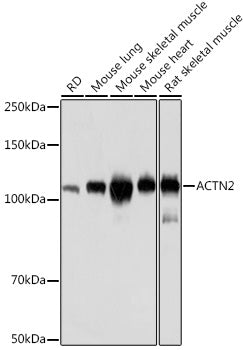 ACTN2 Rabbit mAb