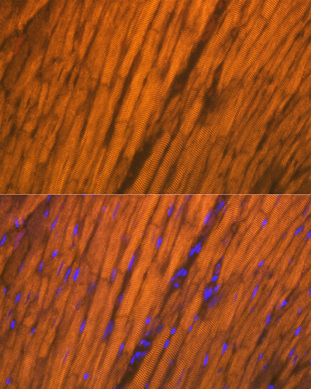 ACTN2 Rabbit mAb