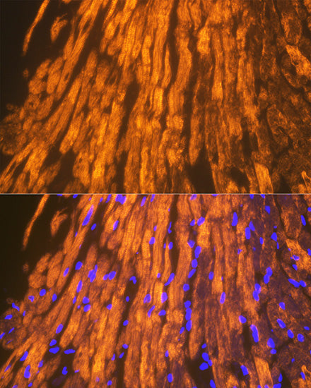 ACTN2 Rabbit mAb