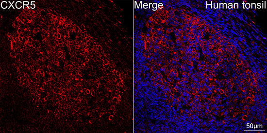 CXCR5 Rabbit mAb