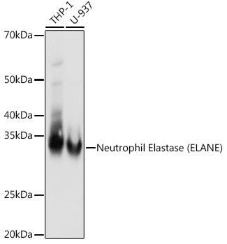 Neutrophil Elastase (ELANE) Rabbit mAb