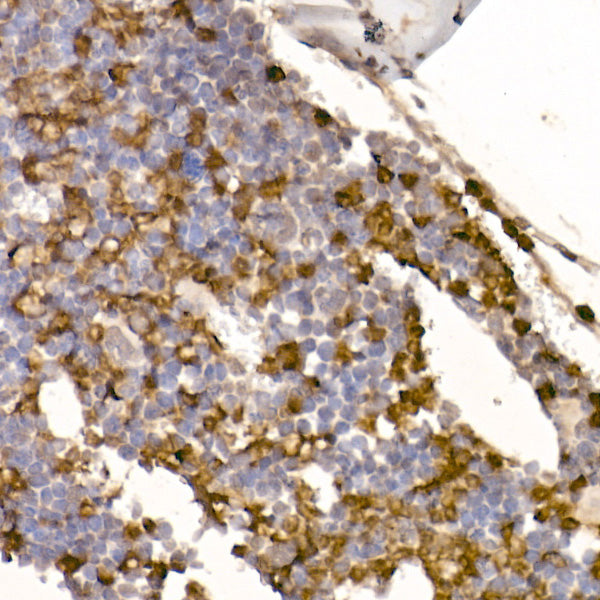 Neutrophil Elastase (ELANE) Rabbit mAb