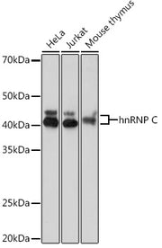 hnRNP C Rabbit mAb